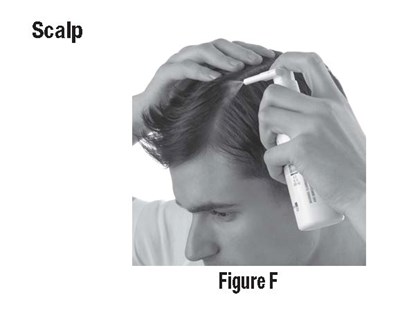 Figure F